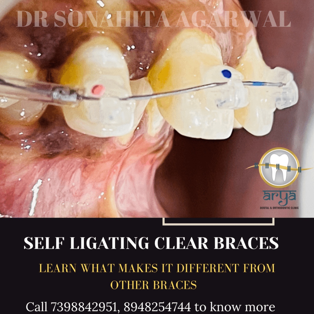 02A4ECFB-BF84-423B-A2FF-67620A2779A6