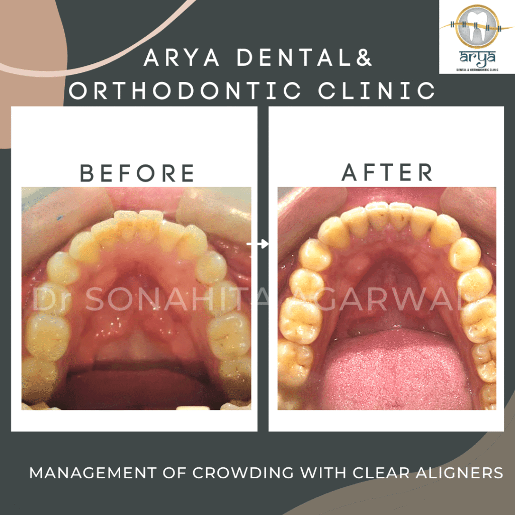 143E37D5-514E-4F4A-B8A1-1CD37FCCFF34