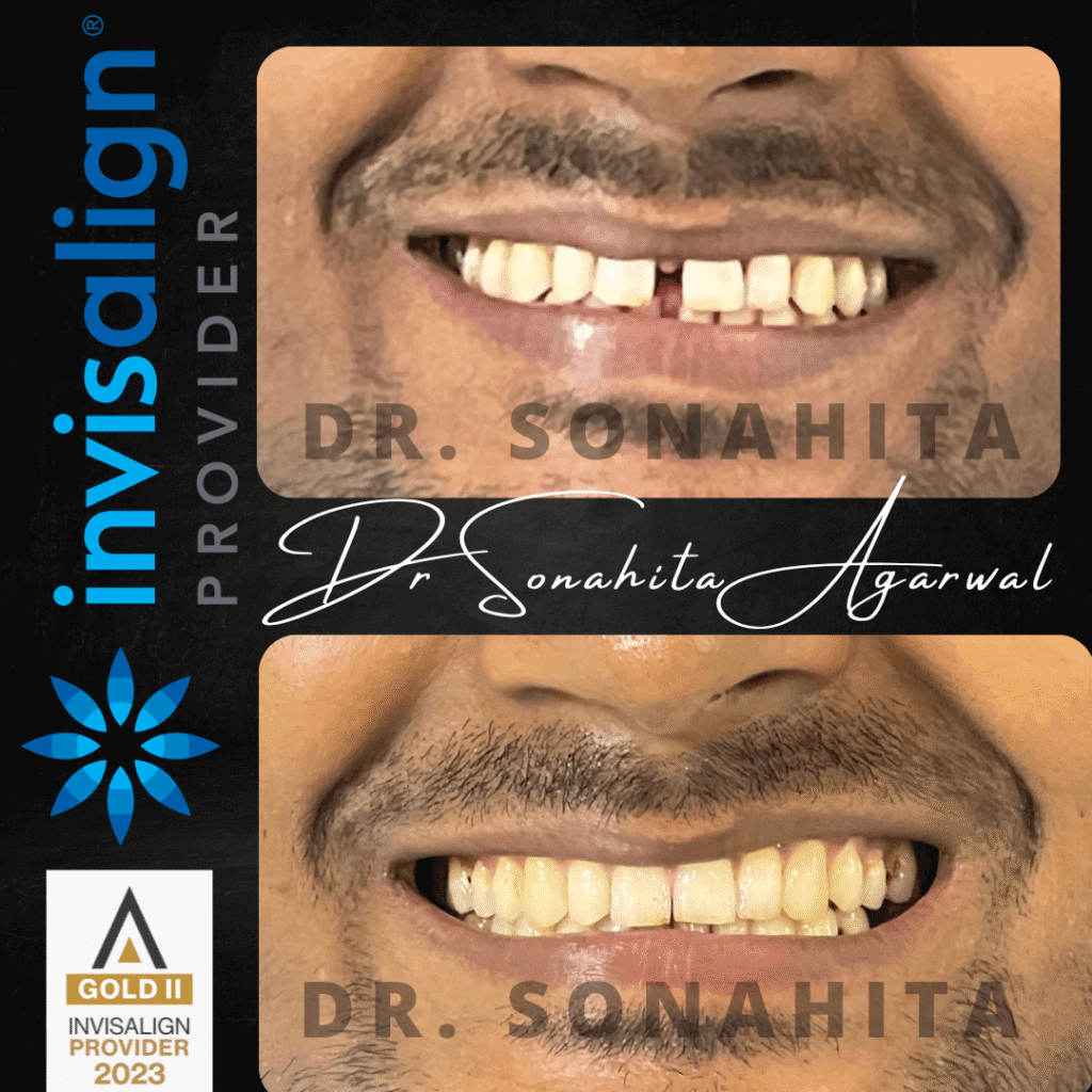 8B16ED2E-80EF-4354-9386-1C7320AA6BC1