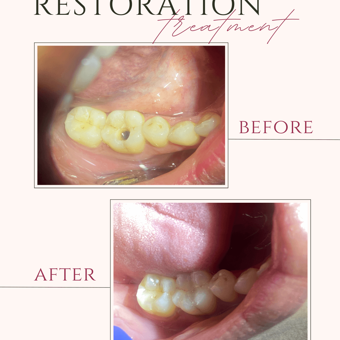 Beige and Pink Elegant Brows Treatment Before After Instagram Post (4)