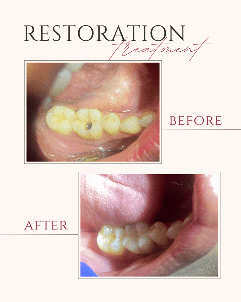 Beige and Pink Elegant Brows Treatment Before After Instagram Post (4)