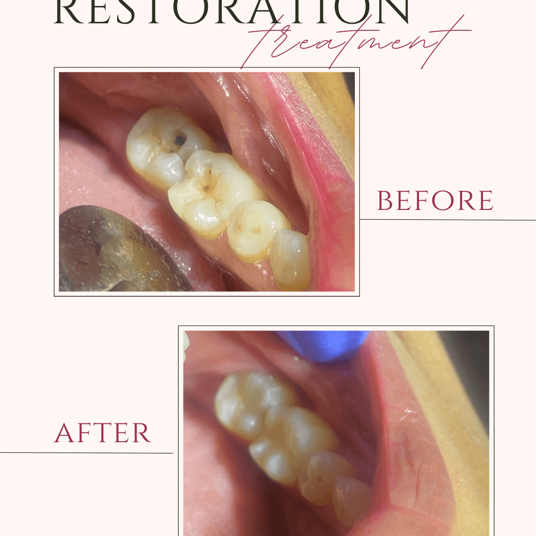 Beige and Pink Elegant Brows Treatment Before After Instagram Post (5)