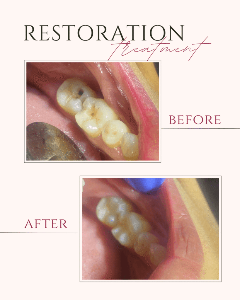 Beige and Pink Elegant Brows Treatment Before After Instagram Post (5)