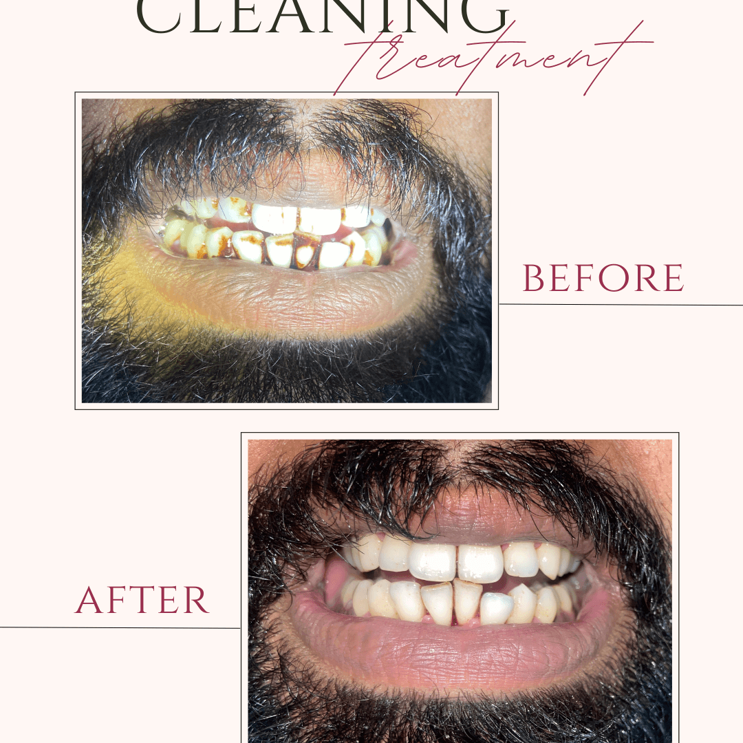 Beige and Pink Elegant Brows Treatment Before After Instagram Post (6)