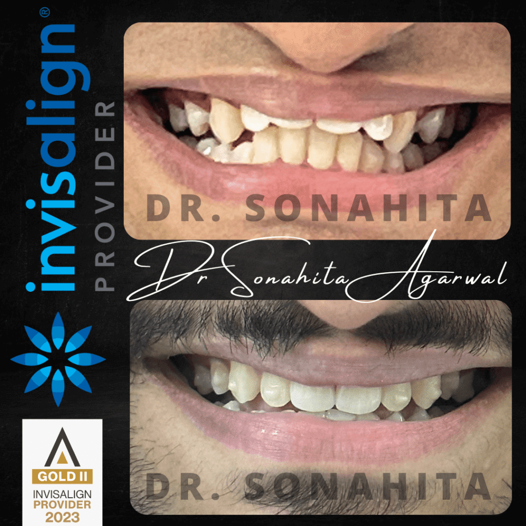 Dr Sonahita Agarwal.png