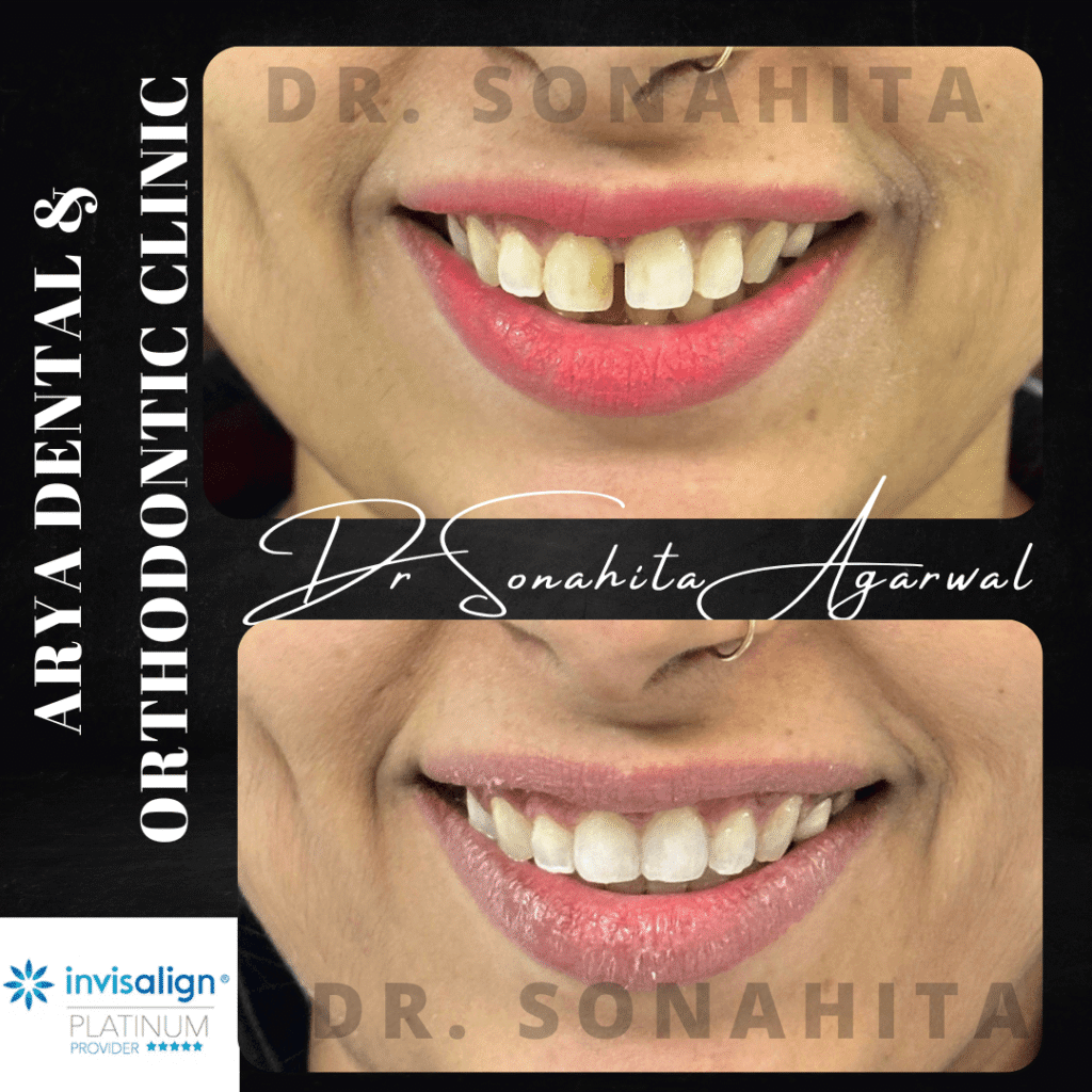 Dr Sonahita Agarwal.zip - 80