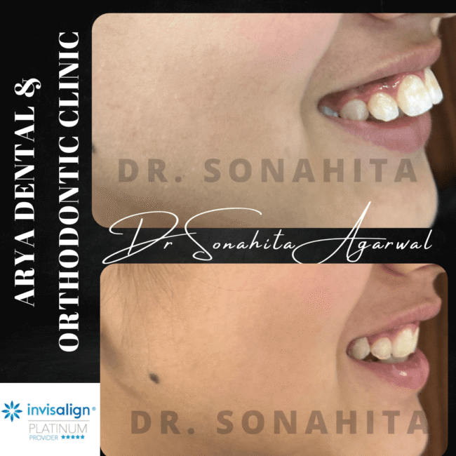 Dr Sonahita Agarwal_2 Dr Sonahita Agarwal_2