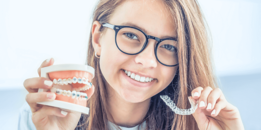 braces vs aligners for kids